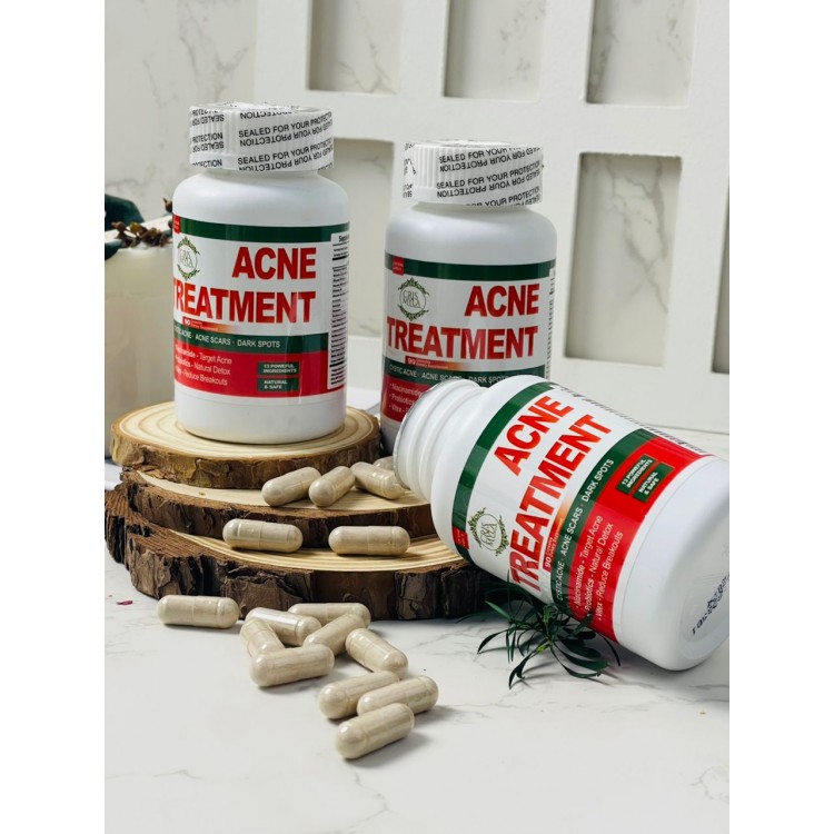Acne Treatment - Wholesales